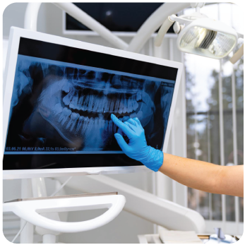 Dental X-Ray